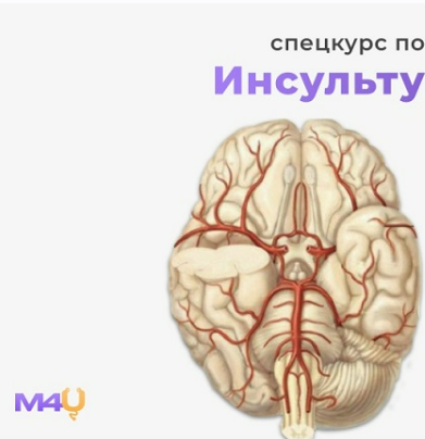 [Medforyou - школа медицины] Спецкурс по инсульту (2025)